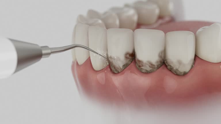 Trusted Teeth Whitening service in Pikeville, TN - Dentist Open Now